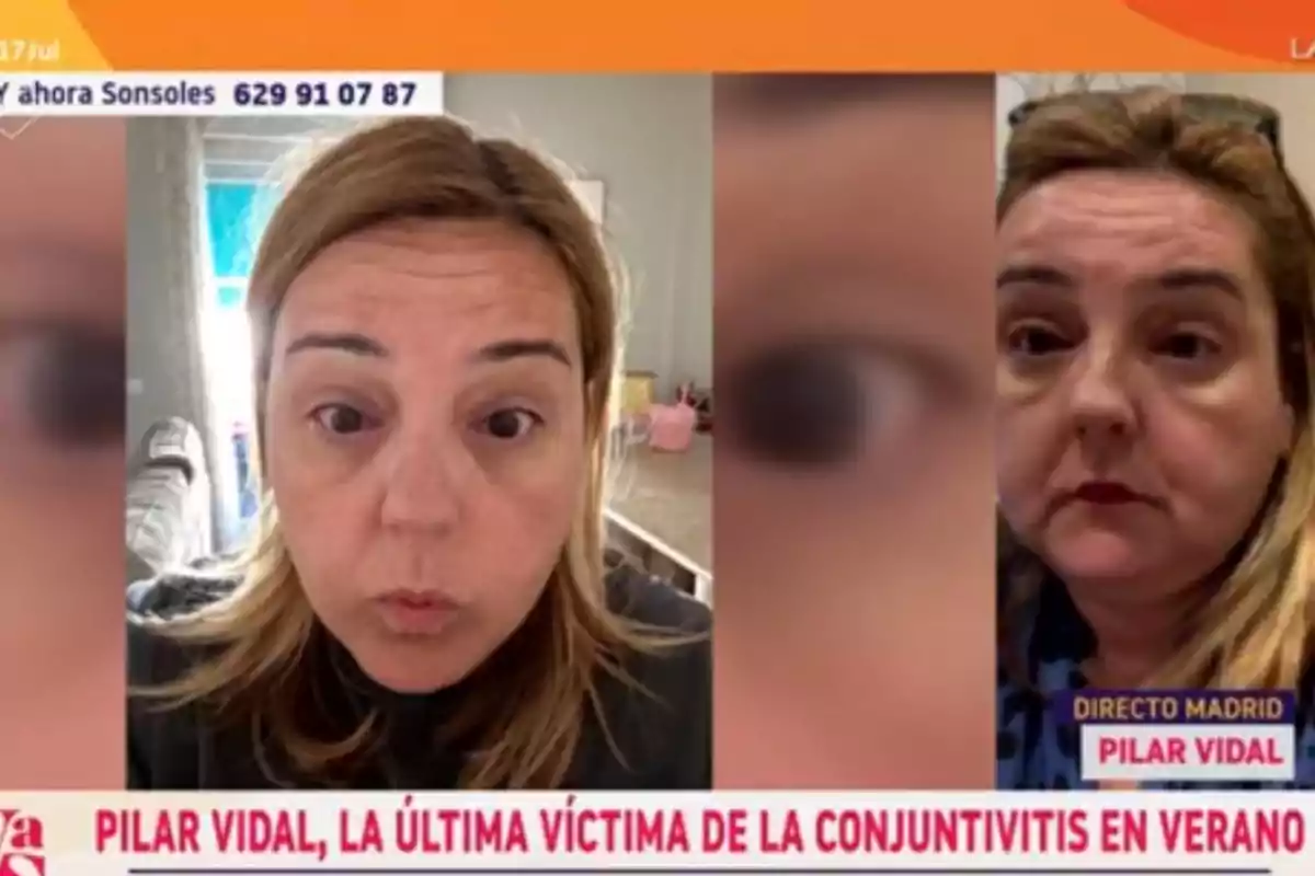 Dos fotografías de Pilar Vidal con el ojo izquierdo enrojecido y aspecto cansado, acompañadas de un titular en la parte inferior que menciona la conjuntivitis en verano Dos fotografías de Pilar Vidal con el ojo izquierdo enrojecido y aspecto cansado, acompañadas de un titular en la parte inferior que menciona la conjuntivitis en verano