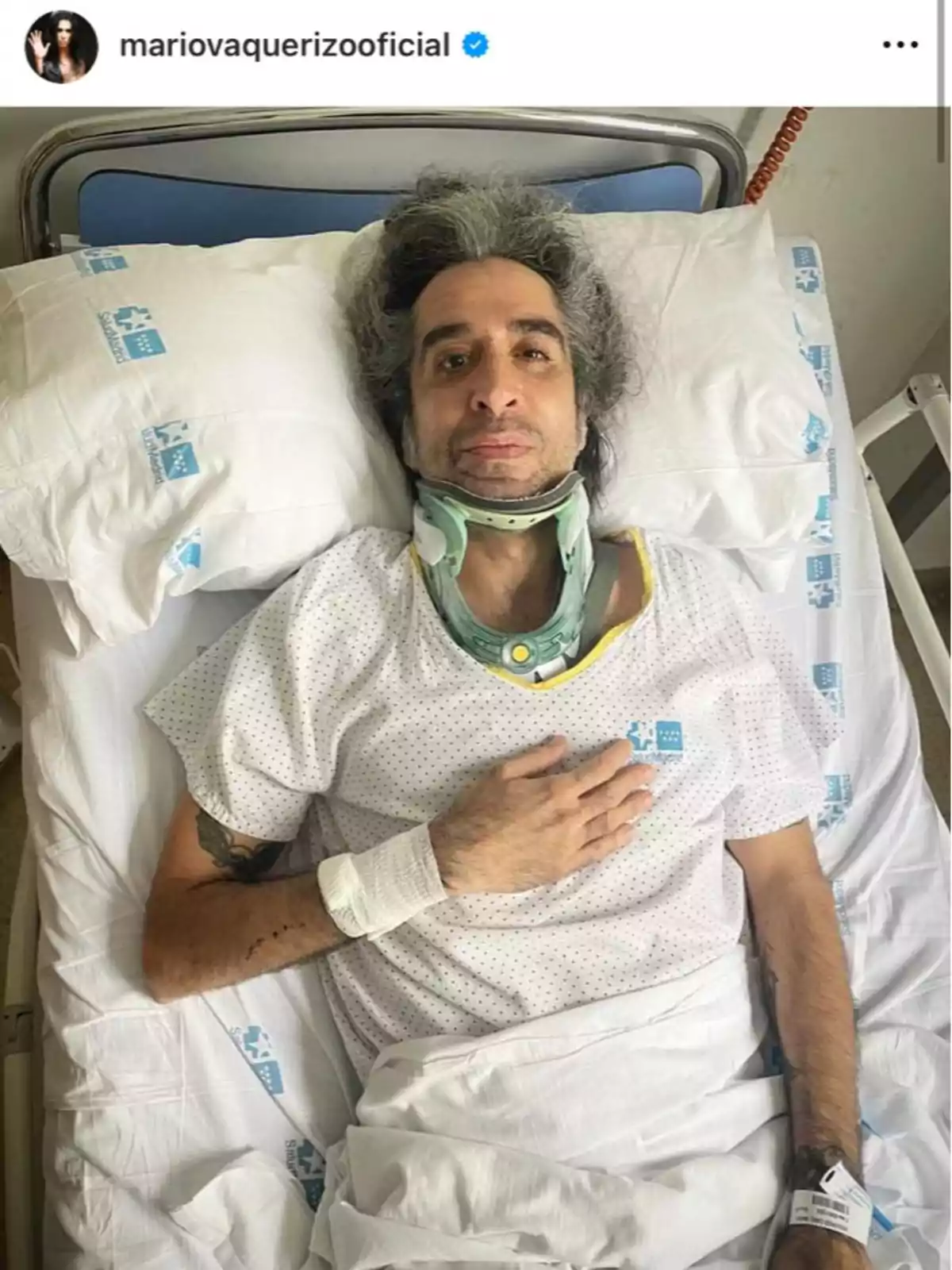 Mario Vaquerizo acostado en una cama de hospital con un collarín y una bata blanca, con una mano sobre el pecho. Mario Vaquerizo acostado en una cama de hospital con un collarín y una bata blanca, con una mano sobre el pecho.