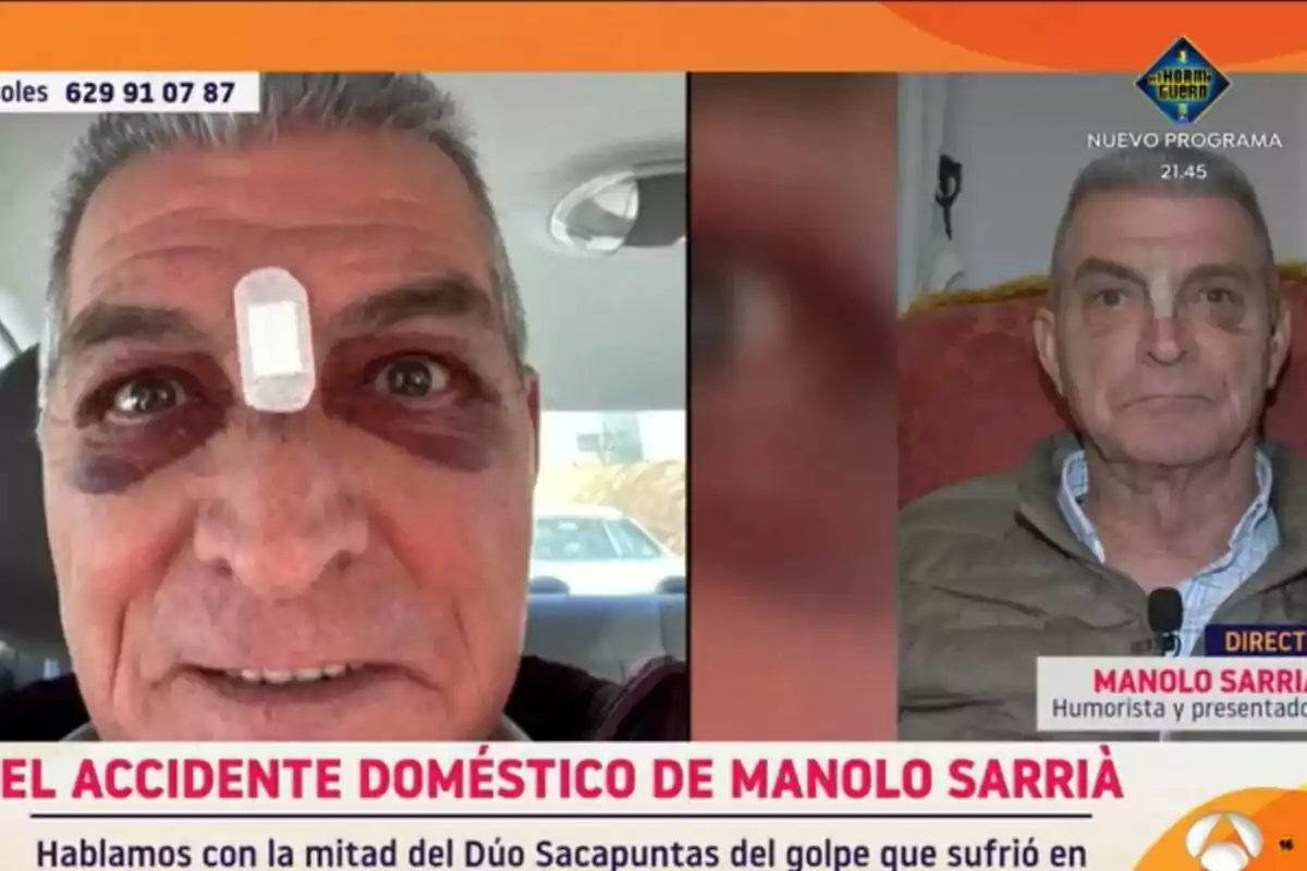 Manolo Sarriá con un vendaje en la frente y moretones alrededor de los ojos aparece en dos imágenes en Y ahora Sonsoles, una en un coche y otra en un programa de televisión. Manolo Sarriá con un vendaje en la frente y moretones alrededor de los ojos aparece en dos imágenes en Y ahora Sonsoles, una en un coche y otra en un programa de televisión.